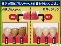 歯茎との関係