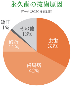 永久歯の抜歯原因