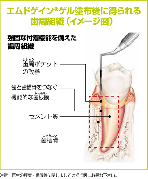 エムドゲインゲルとは？