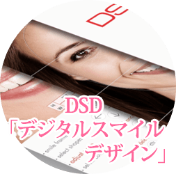 DSD「デジタルスマイルデザイン」
